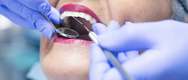 Best Teeth Whitening  in Paw Paw, MI